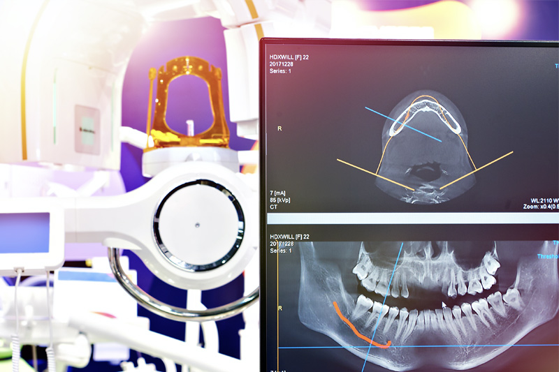 digital-xrays